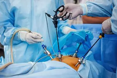 Prostate Surgery in India, Laser Prostate Surgery in India, Best Urologist in India, Best Prostate Surgeon in India, Lowest Cost of Prostate Surgery in India